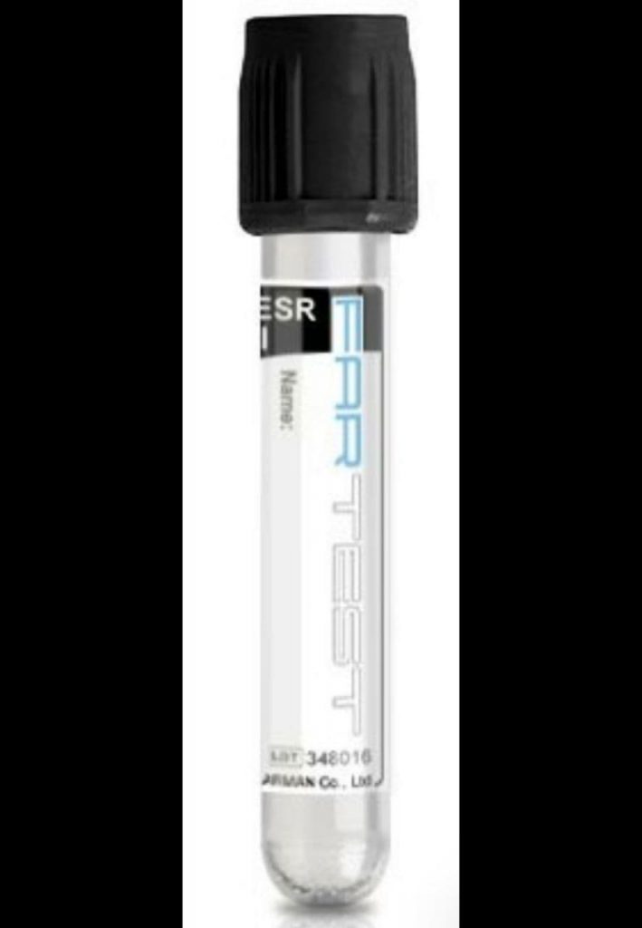 لوله ESR (سدیمان)