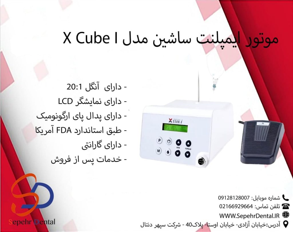 موتور ایمپلنت